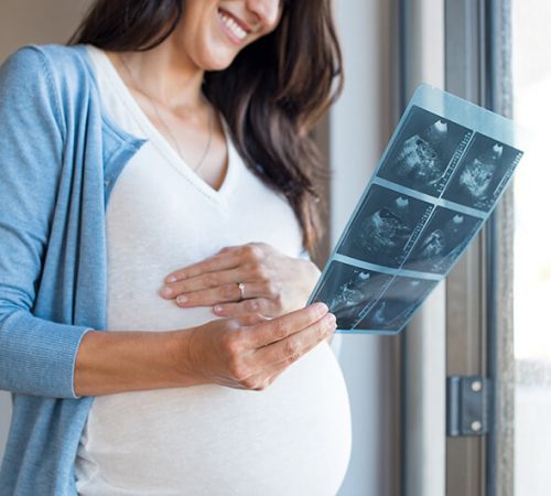 pregnant-woman-holding-ultrasound-PUXVKW6